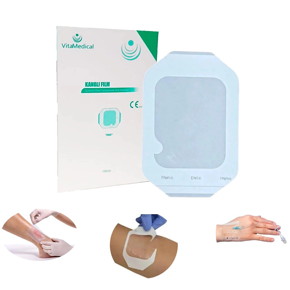 Curativo Placa Filme Adesivo Transparente Sem Fenestra Facil Remoçao Para Cateter Tatuagem Kangli Film 10 x 12 CM Vita Medical Curativo Placa Filme Adesivo Transparente Sem Fenestra Facil Remoçao Para Cateter Tatuagem Kangli Film 10 x 12 CM Vita Medical