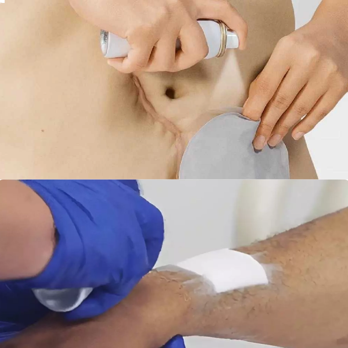 Removedor de Adesivos Splay 50 ML Aerossol Missner 