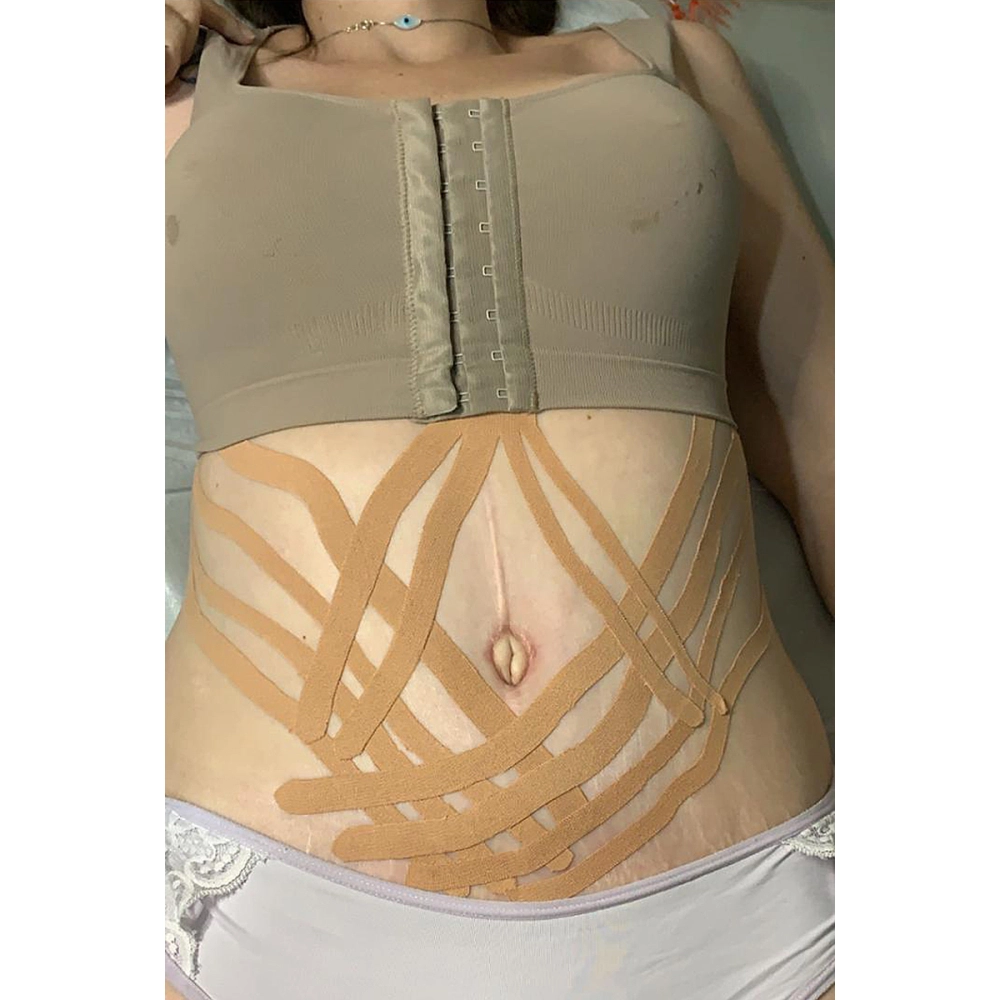 Bandagem Fita Faixa Rolo Kinesiológica Pós Operatório Cinesiologia Hidrofóbica Elástica Autoaderente Funcional 5cm x 6 Metros D3 Tape