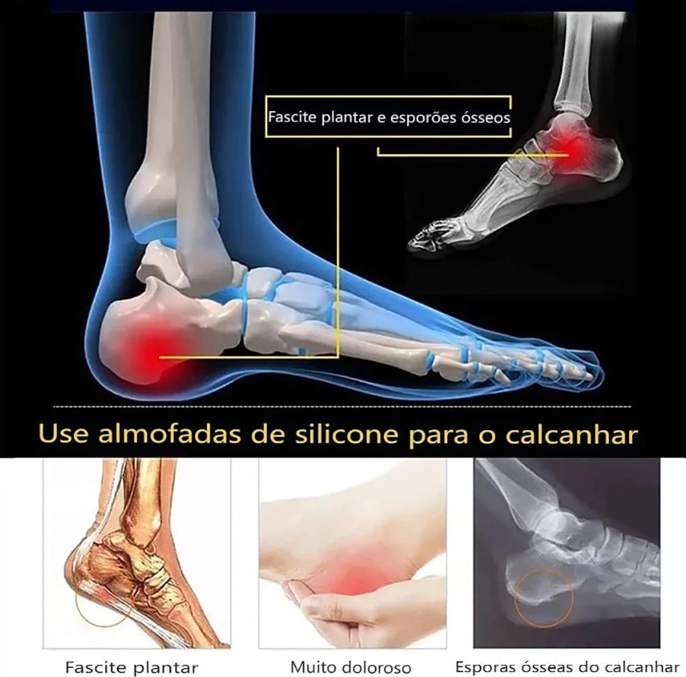 Calcanheira De Silicone Palmilha Calcanhar Ortopédica Gel Alivio Dor Fascite Plantar Esporão Calcaneo Ortho Pauher
