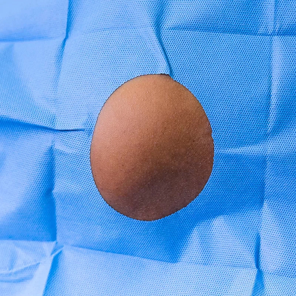 Campo Cirúrgico Descartável Estéril Fenestrado Polipropileno 40 x 40 cm Azul Protdesc