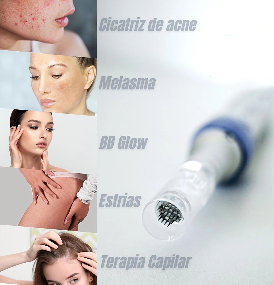 Caneta Eletrica de Microagulhamento Estetica Clinica Acessorios Smart Pen