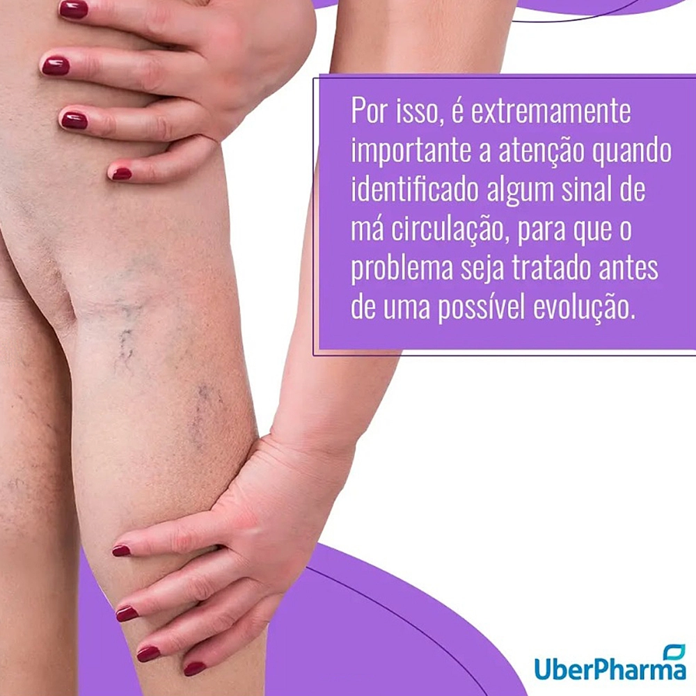 Creme Para Varizes Vasos Dores Inchaços Hidratante Protetor De Pele Dermatologico Venoxflam 300 ML