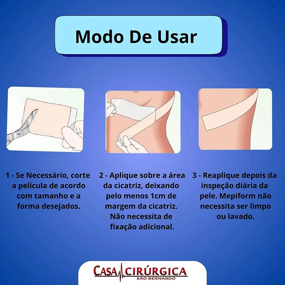 Curativo Adesivo Em Placa Mepiform Tratamento Para Cicatrizes Queloide Molnlycke