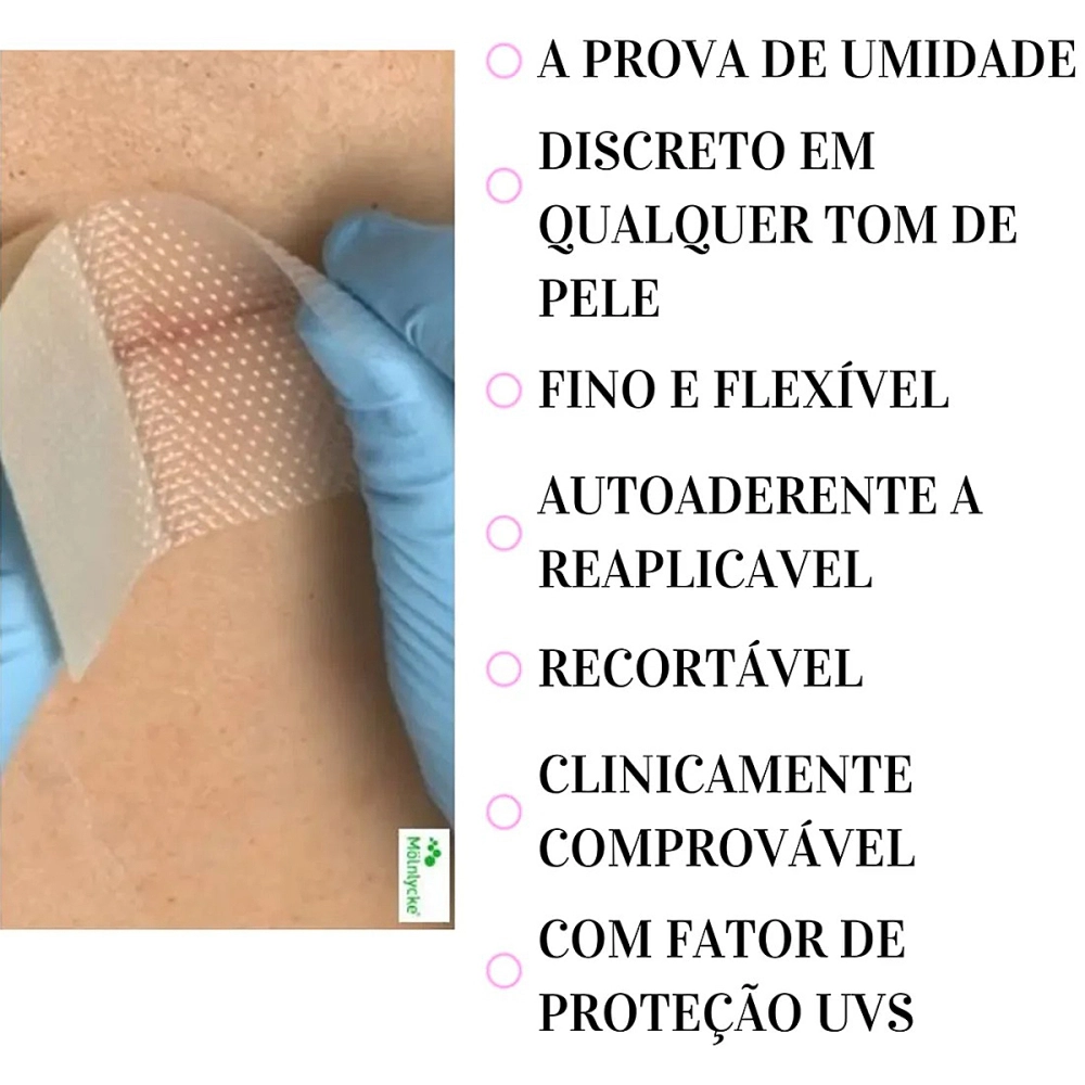Curativo Adesivo Em Placa Mepiform Tratamento Para Cicatrizes Queloide Molnlycke