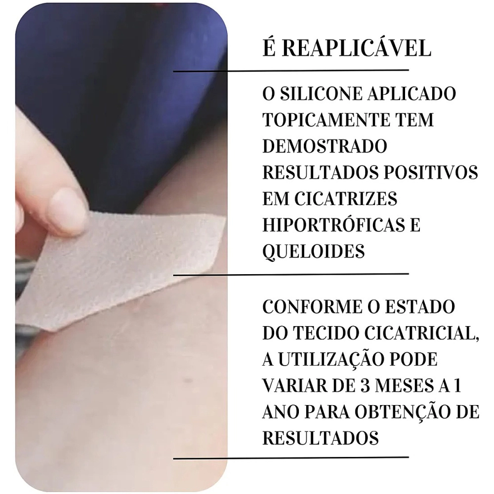 Curativo Adesivo Em Placa Mepiform Tratamento Para Cicatrizes Queloide Molnlycke