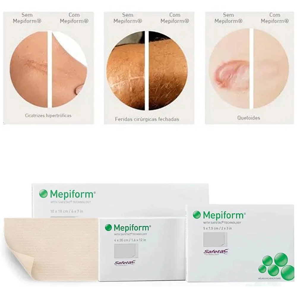Curativo Adesivo Em Placa Mepiform Tratamento Para Cicatrizes Queloide Molnlycke