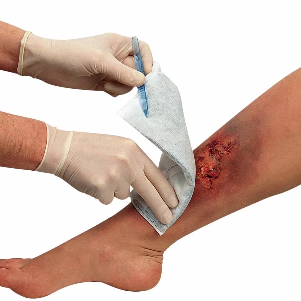 Curativo De Carvão Ativado Com Prata Esterilizado Para Infecções Controle De Odores AG Vita Medical