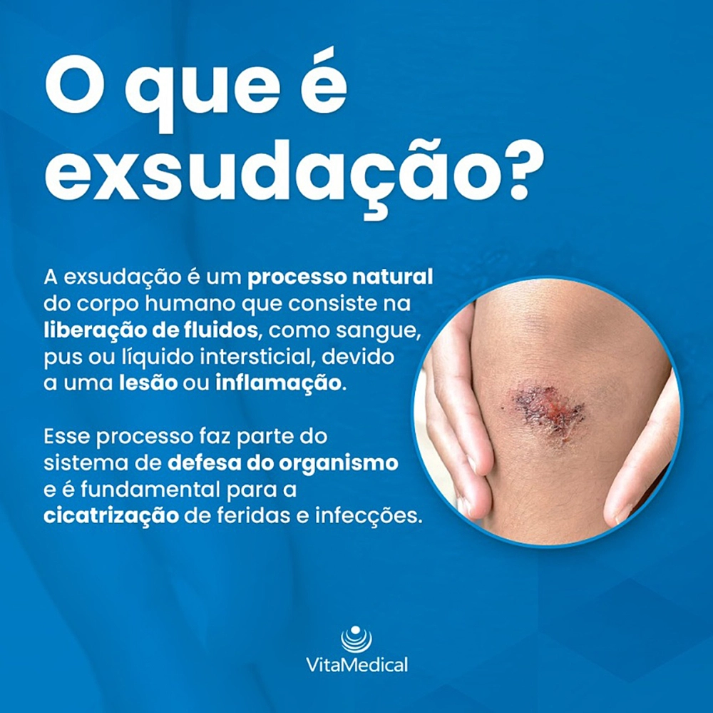 Curativo De Fibras De Alginato De Cálcio Com Prata Ação Microbiano Absorção De Exsudato Silver Care 10 x 10 CM VitaMedic