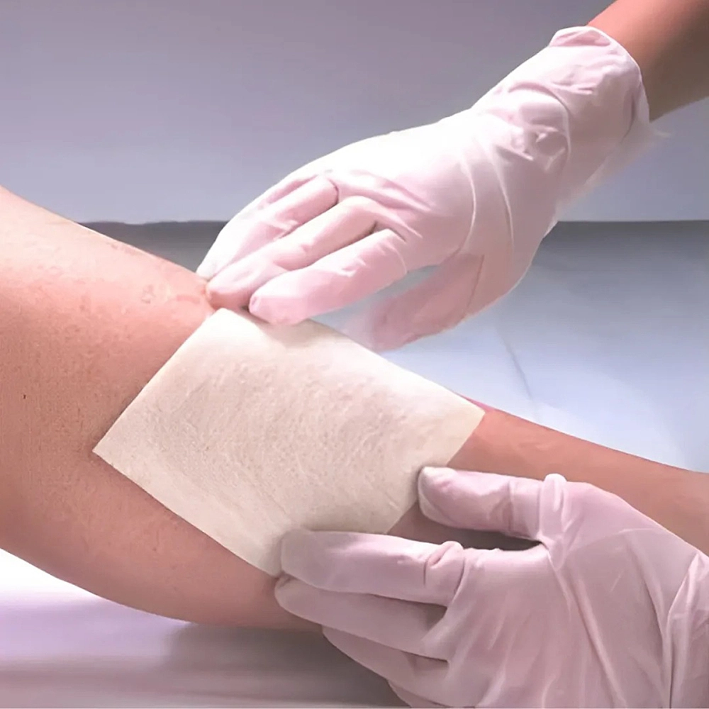 Curativo De Fibras De Alginato De Cálcio Sódio Absorção De Exsudato  Kangli Sorb VitaMedical