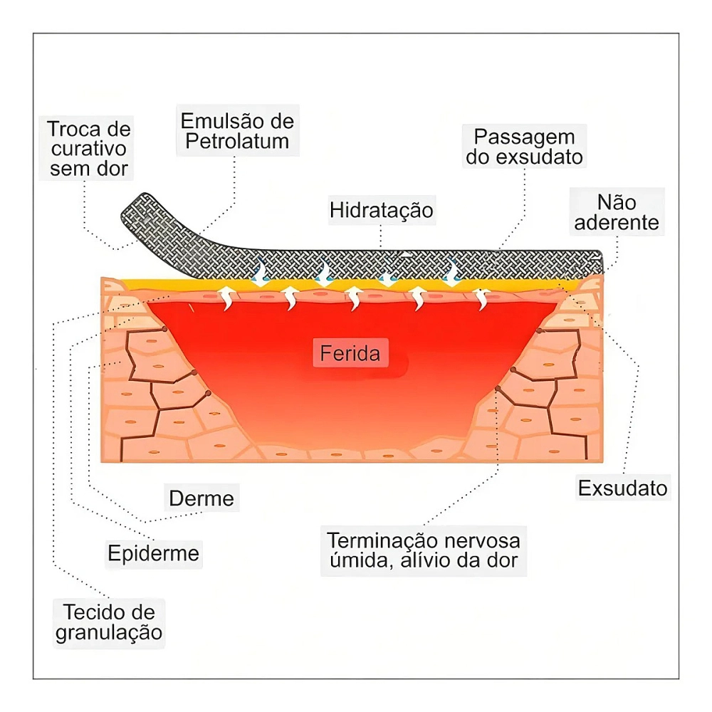 Curativo De Fibras De Alginato De Cálcio Sódio Absorção De Exsudato  Kangli Sorb VitaMedical