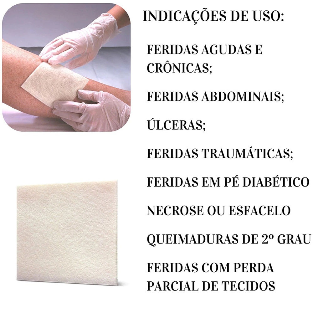 Curativo De Fibras De Alginato De Cálcio Sódio Absorção De Exsudato  Kangli Sorb VitaMedical