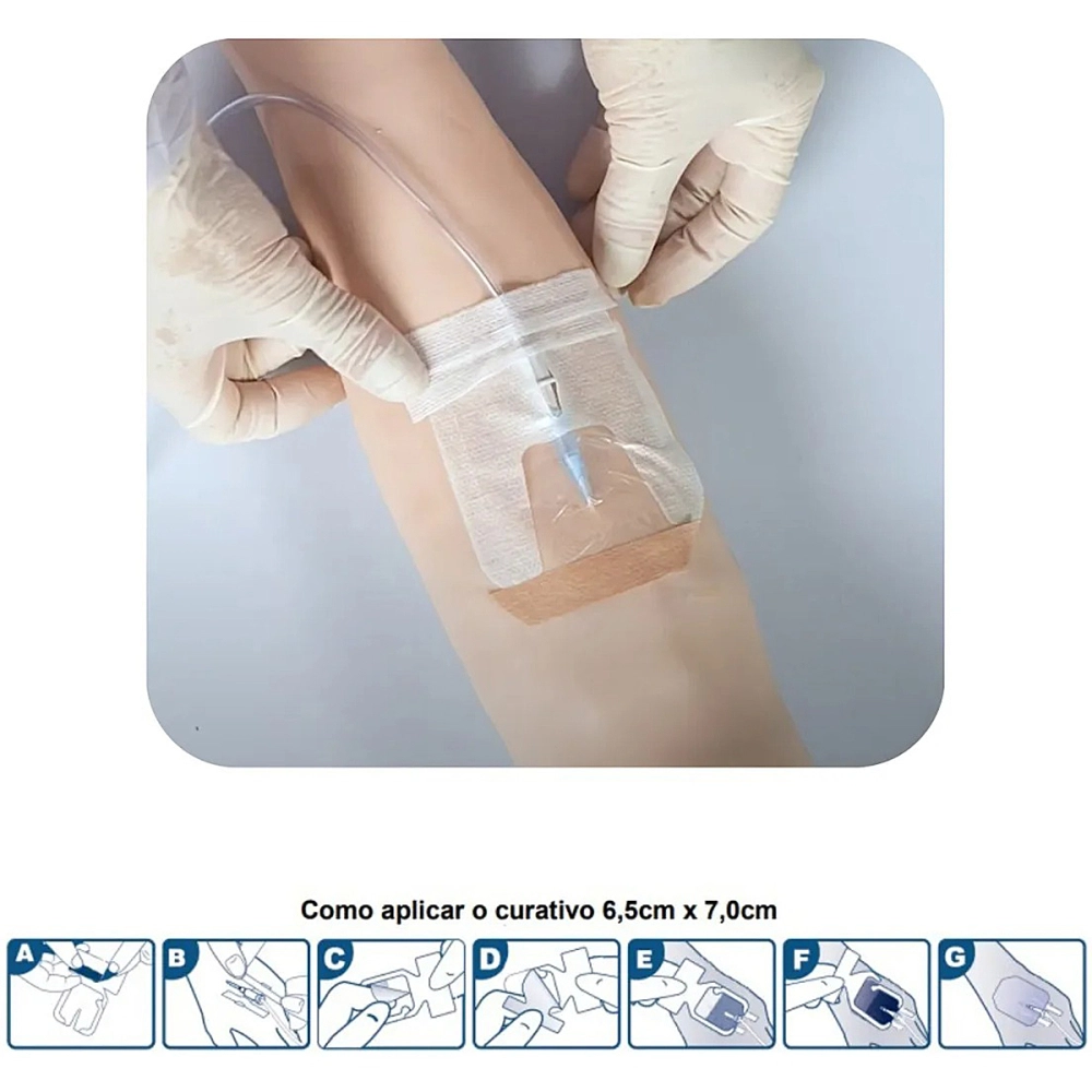 Curativo De Fixaçao IV Para Cateter Periferico 6,5CMx7CM Acesso Venoso Acesso Central Com PU Impermeavel E Transparente