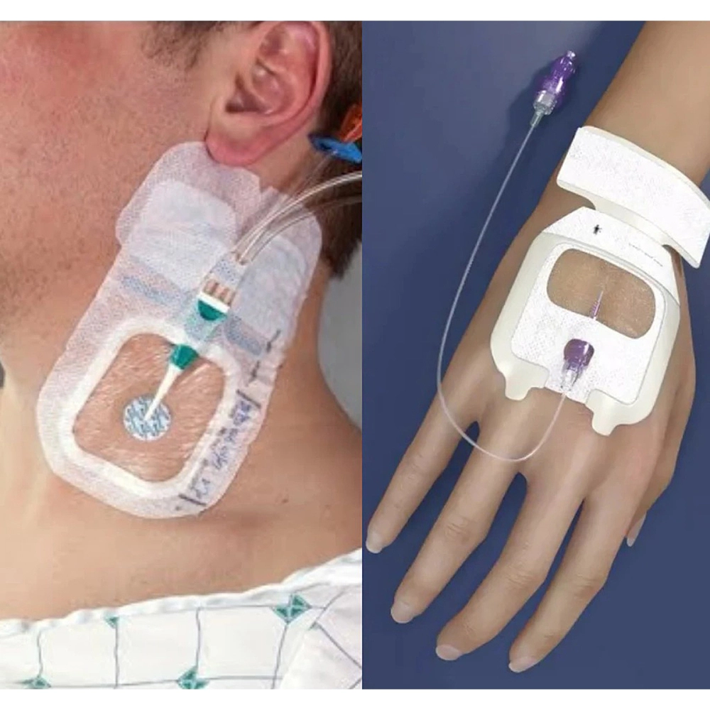 Curativo De Fixaçao IV Para Cateter Periferico 6,5CMx7CM Acesso Venoso Acesso Central Com PU Impermeavel E Transparente