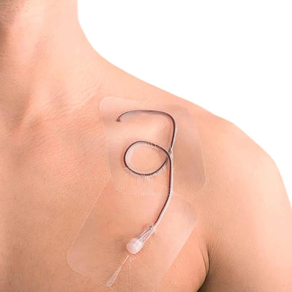 Curativo Placa Filme Adesivo Transparente Sem Fenestra Facil Remoçao Para Cateter Tatuagem Kangli Film 10 x 12 CM Vita Medical