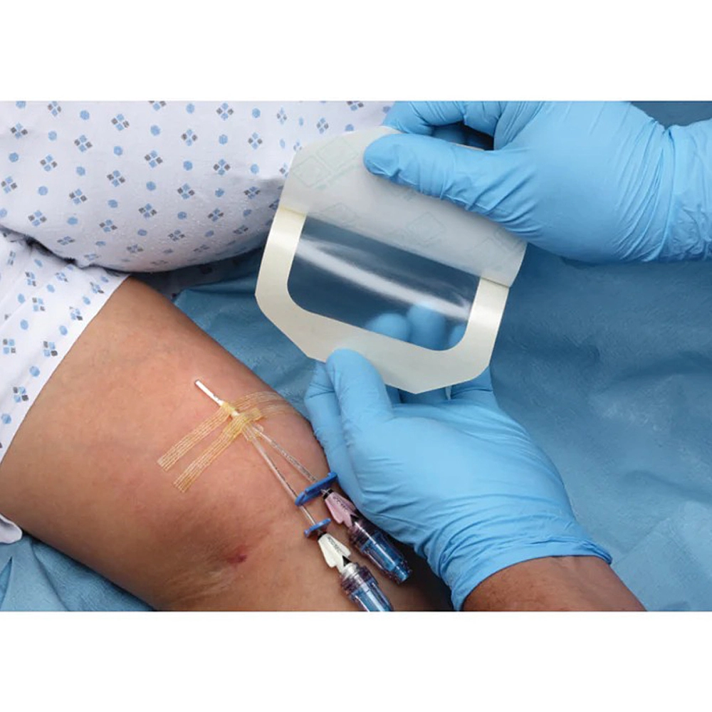 Curativo Placa Filme Adesivo Transparente Sem Fenestra Facil Remoçao Para Cateter Tatuagem Kangli Film 10 x 12 CM Vita Medical