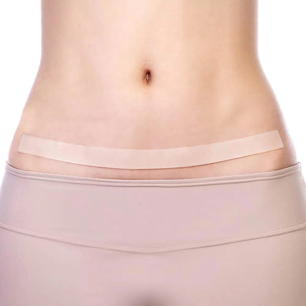 FITA ADESIVA SILICONE EM GEL PARA QUELOIDE CICATRIZ BARIATRICA ABDOMINOPLASTIA 65 x 3 CM SILIFORMA  