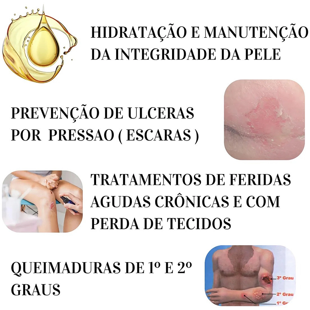 Gaze De Rayon Curativo Sache Estéril Embebida Com Óleo De Girassol Copaíba Melaleuca Age Pielsana