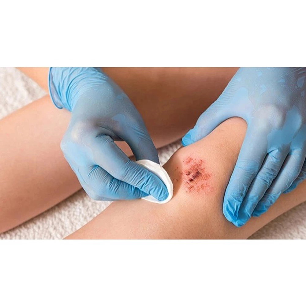 Hidrogel Pomada Hidratante Gel AllyGel Para Tratamento De Feridas Amorfo Curativo Com Alginato 85 Gramas Casex