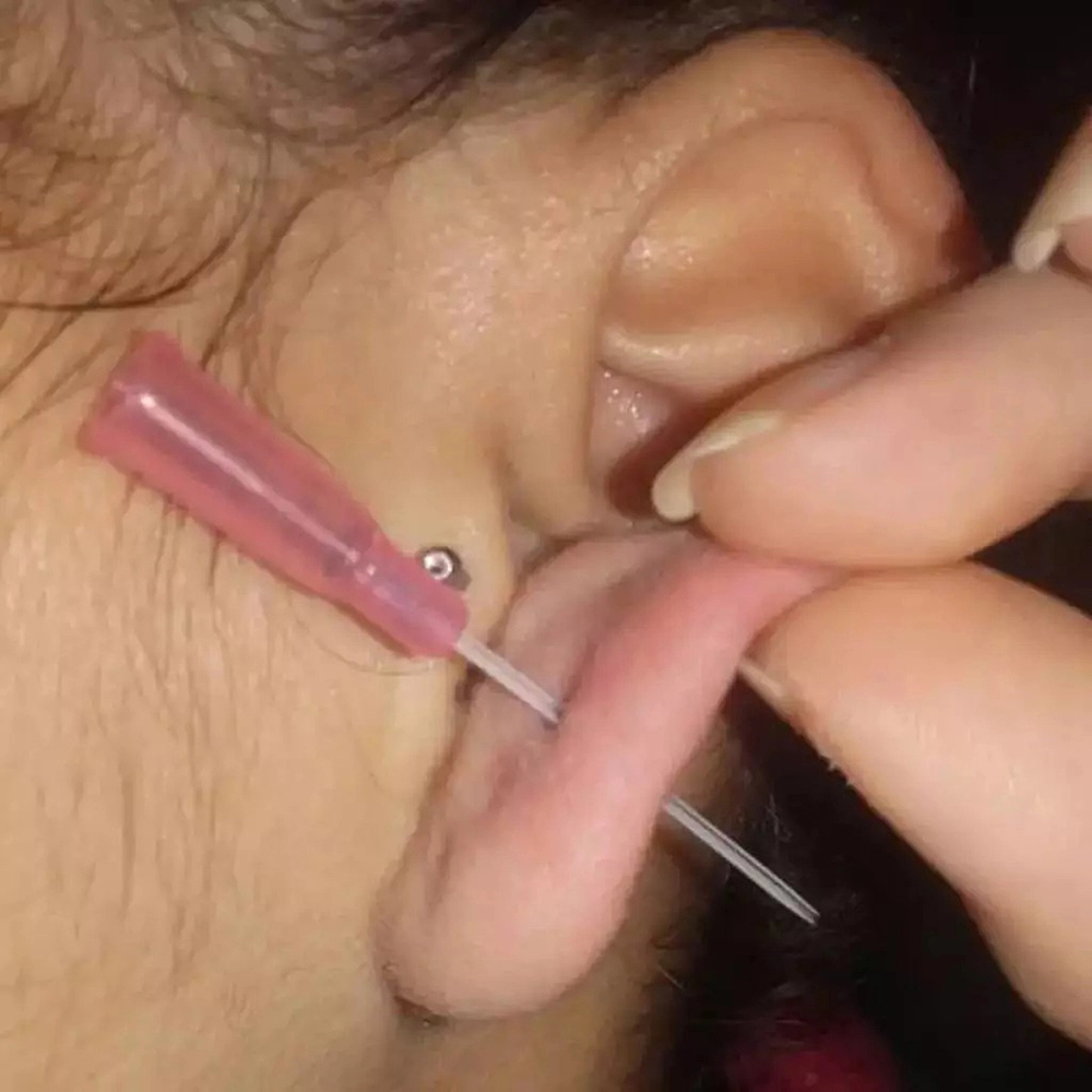 Kit Cateteres Intravenoso Periferico Body Piercing Esteril Para Infusoes De Media E Longa Duraçao Medix