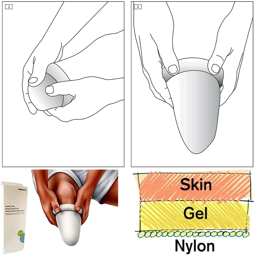 Revestimento De Silicone Meia De Proteção Para Coto Derma Seal Branca 453D7 Ottobock